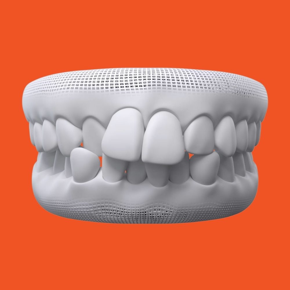 Crowding & overlapping teeth