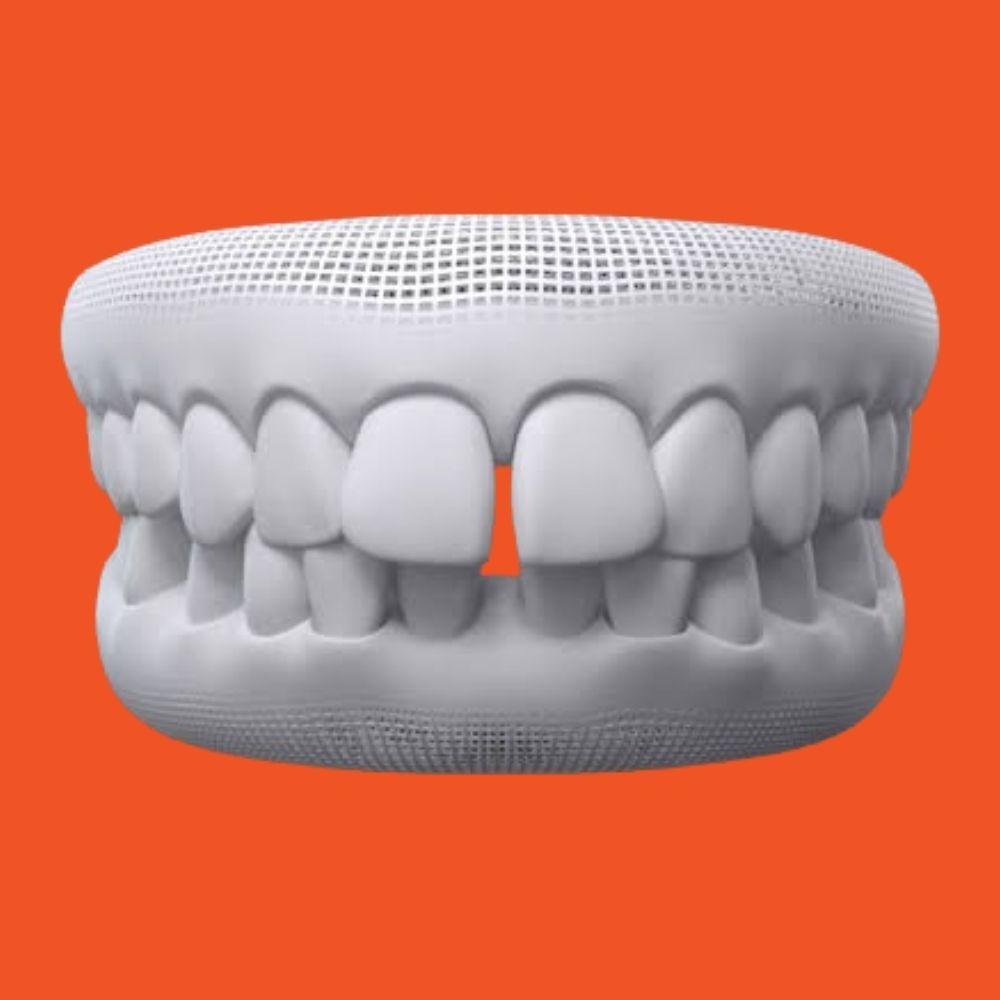 gapped teeth